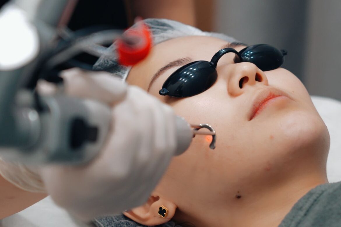 Advanced Laser Therapies Targeting Pigmentation Irregularities For Smooth, Even Skin Texture